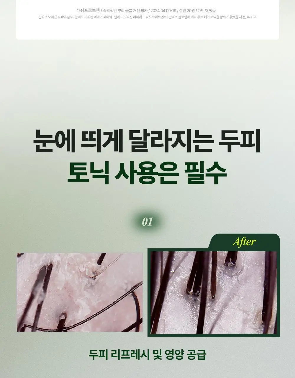 [1등헤어토닉] 달리프 클로렐라 탈모증상완화 헤어토닉 더블기획(100ml+100ml) 상세페이지 24